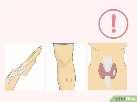 Imagen titulada Know if You Have a Lipoma Step 9