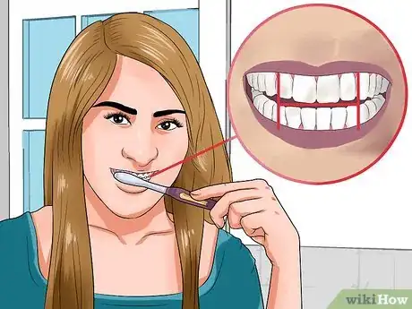 Imagen titulada Clean Teeth With Braces Step 3