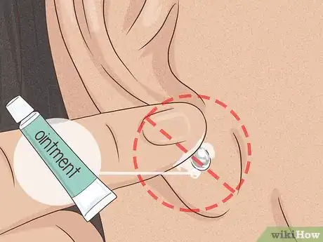 Imagen titulada Clean a New Ear Piercing Step 13