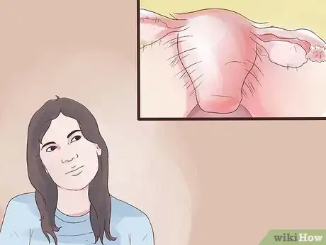 Imagen titulada Treat Blocked Fallopian Tubes Step 10