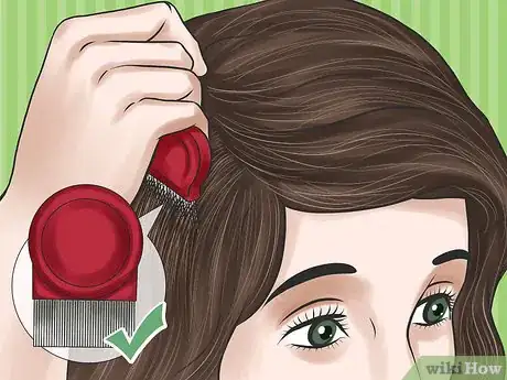 Imagen titulada Get Rid of Lice Step 2