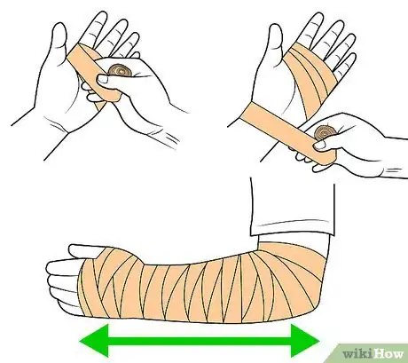 Imagen titulada Wrap a Wrist Step 2