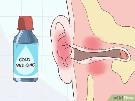 Imagen titulada Reduce Ear Swelling Step 11