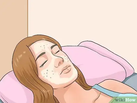 Imagen titulada Treat Acne With Banana Peels Step 5