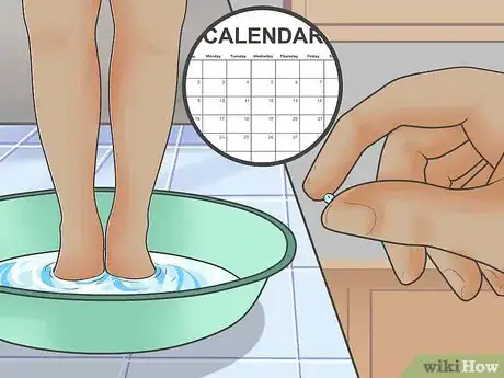 Imagen titulada Tell if You Have an Ingrown Toenail Step 8