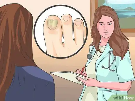 Imagen titulada Tell if You Have an Ingrown Toenail Step 5