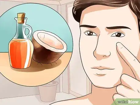 Imagen titulada Get Rid of Redness on the Face Step 6