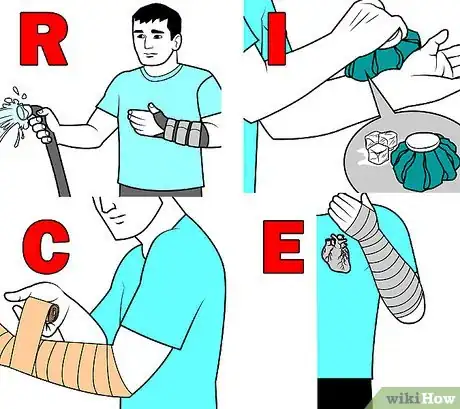 Imagen titulada Wrap a Wrist Step 9