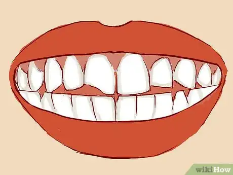 Imagen titulada Treat a Broken Tooth Step 3