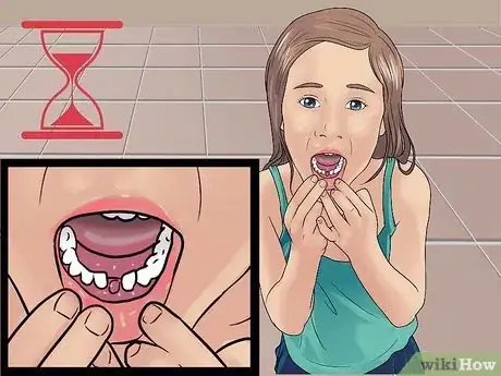 Imagen titulada Stop the Bleeding After You Pull out a Loose Tooth Step 1