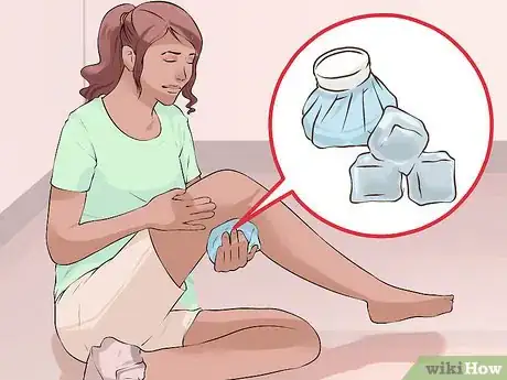 Imagen titulada Cure a Baker's Cyst Step 3