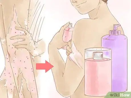 Imagen titulada Exfoliate Your Body for Soft Skin Step 10