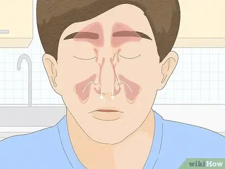 Imagen titulada Soothe a Sore and Irritated Nose After Frequent Blowing Step 7