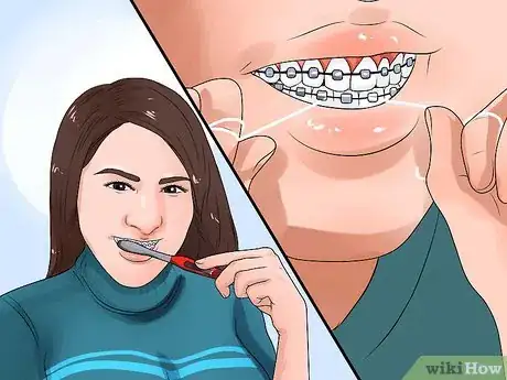 Imagen titulada Clean Teeth With Braces Step 8