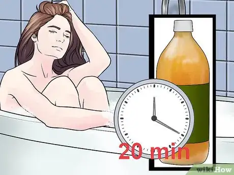 Imagen titulada Relieve Vaginal Burning Step 14