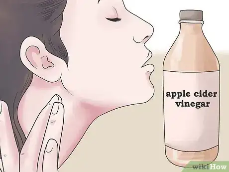 Imagen titulada Treat an Infected Sebaceous Cyst Step 9