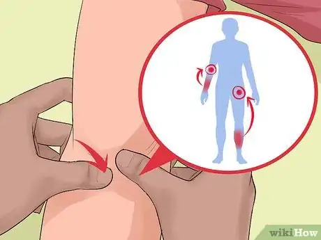 Imagen titulada Treat Severe Bleeding During First Aid Step 8