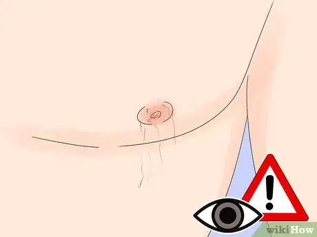 Imagen titulada Lighten Nipples Step 8