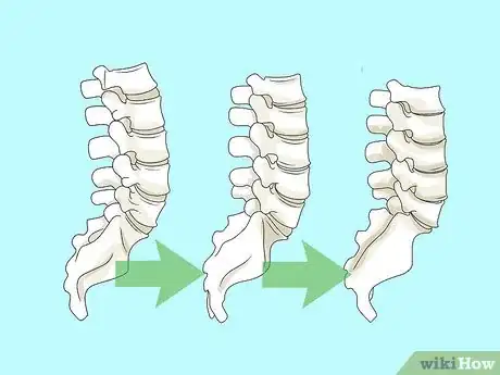 Imagen titulada Study Pathology Step 4