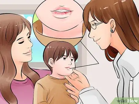 Imagen titulada Fix a Toddler's Chapped Lips Step 12