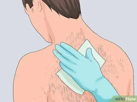 Imagen titulada Get Rid of Back Hair Step 17