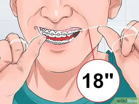 Imagen titulada Clean Teeth With Braces Step 5