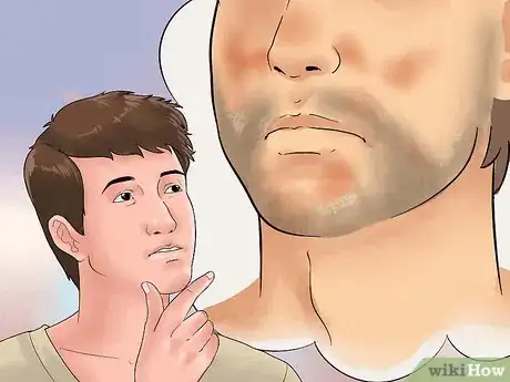 Imagen titulada Treat Seborrheic Dermatitis on Your Face Step 1