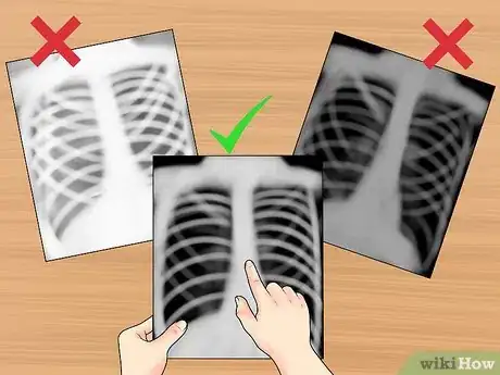 Imagen titulada Read a Chest X Ray Step 5