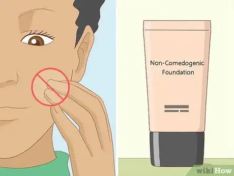 Imagen titulada Instantly Get Rid of a Pimple (Cotton Ball Popping Method) Step 11