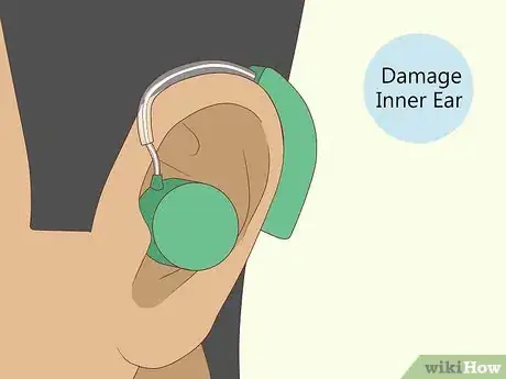 Imagen titulada Improve Your Hearing Step 3