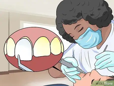 Imagen titulada Restore Tooth Enamel Step 9