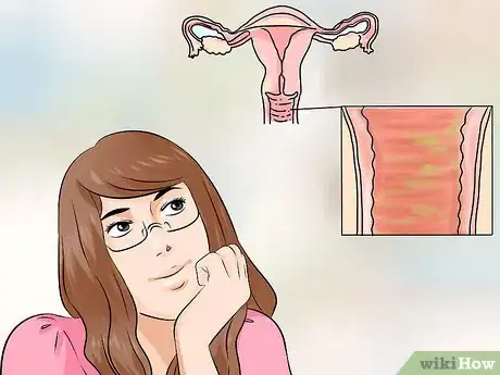 Imagen titulada Treat Vaginitis Step 6