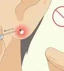 tratar un piercing infectado