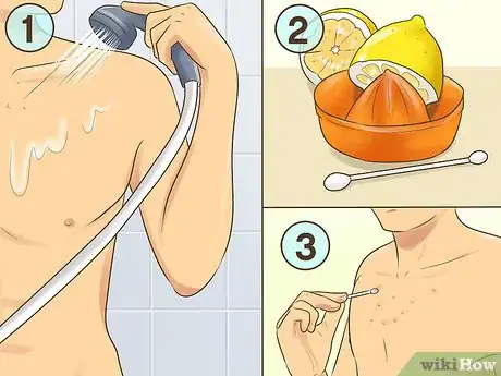 Imagen titulada Get Rid of Acne Scars on Your Chest Step 12