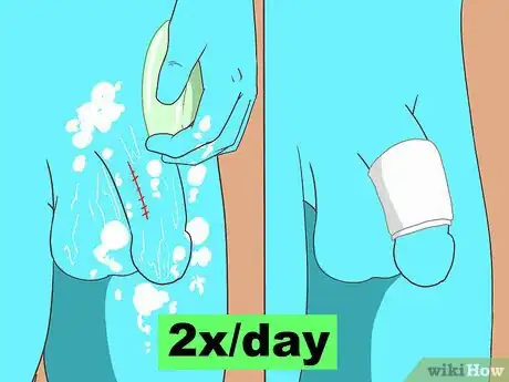 Imagen titulada Get Rid of Genital Warts Step 11