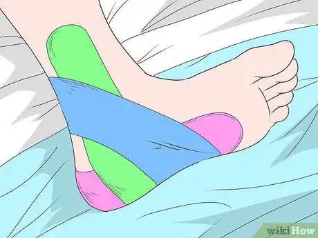 Imagen titulada Treat a Heel Bruise Step 7