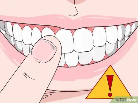 Imagen titulada File Down a Sharp Tooth Step 8