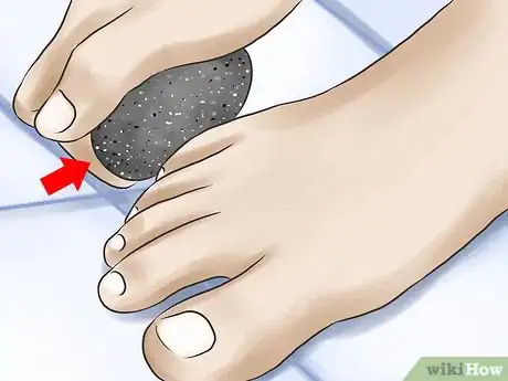 Imagen titulada Clean Toe Nails Step 8