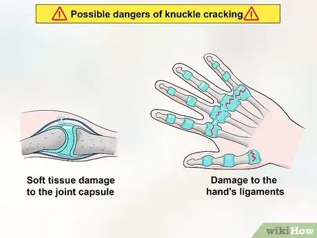 Imagen titulada Stop Cracking Your Knuckles Step 2