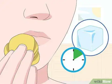 Imagen titulada Get Rid of Mouth Blisters Step 2