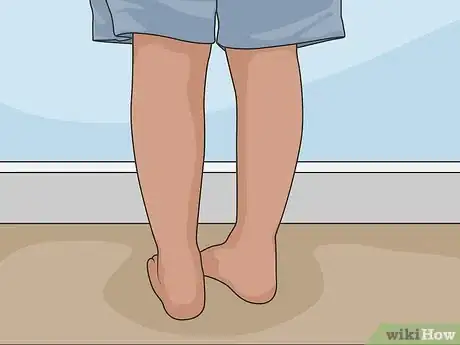 Imagen titulada Remove Scars on Legs Step 01