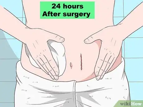 Imagen titulada Reduce Abdominal Swelling After a Surgery Step 2