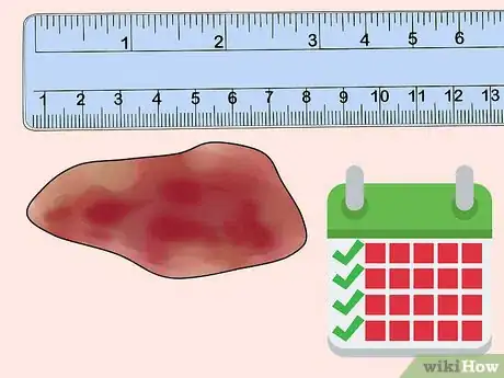 Imagen titulada Measure Wounds Step 13