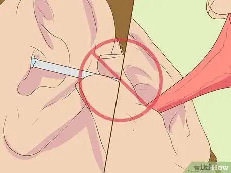 Imagen titulada Use Ear Candles Step 23