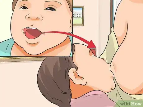 Imagen titulada Heal a Cracked Nipple when Breastfeeding Step 7