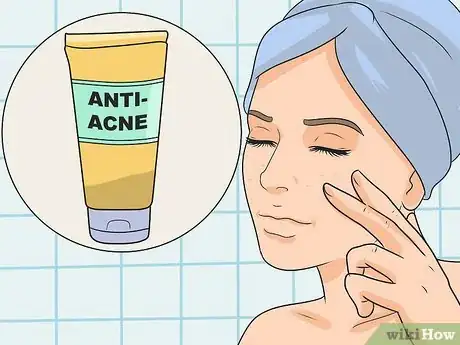 Imagen titulada Get Rid of Red Acne Marks Step 2