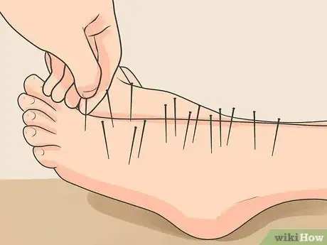 Imagen titulada Treat Neuropathy in Feet Step 5