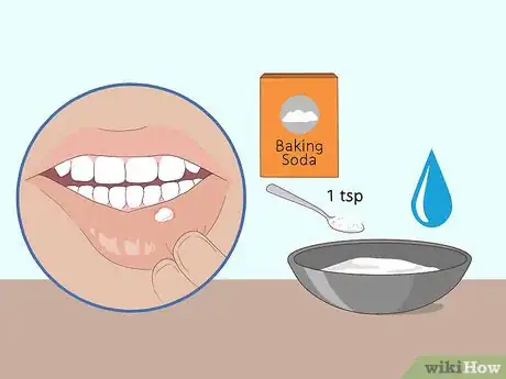 Imagen titulada Get Rid of Mouth Blisters Step 9