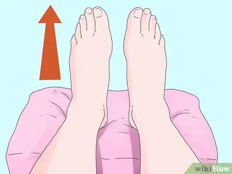 Imagen titulada Cure or Alleviate Edema Step 2