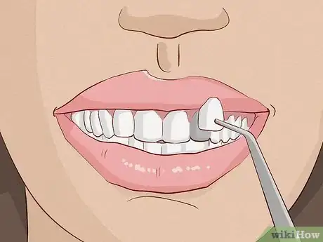 Imagen titulada Smile when You Think You Have Bad Teeth Step 9